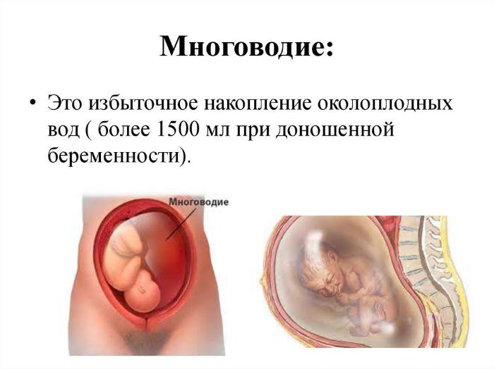 Как определить подтекание вод при беременности в домашних условиях thumbnail